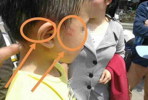第352页